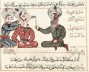 Sra. Tur Turc 693 fol.29v Cauterização de Scrofula, 1466